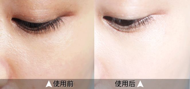 日本腾素效果如何?实测30天揭秘真相与避坑诀窍 日本腾素效果如何?实测30天揭秘真相与避坑诀窍